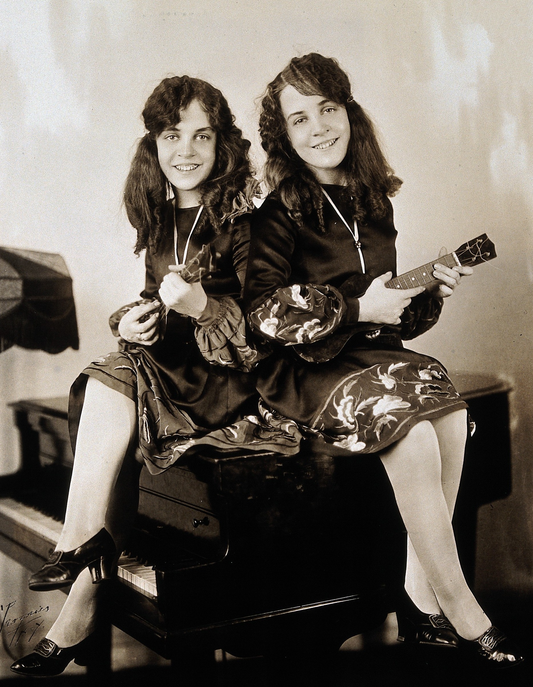 Daisy and Violet Hilton c1927d