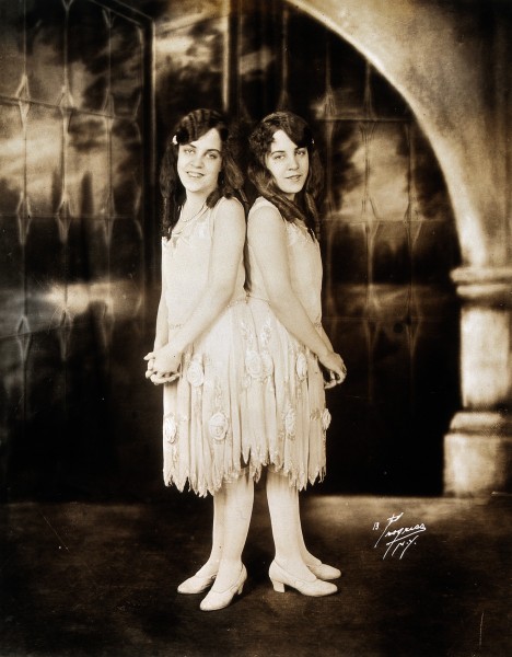 Daisy and Violet Hilton, conjoined twins, dressed up for per Wellcome V0029584