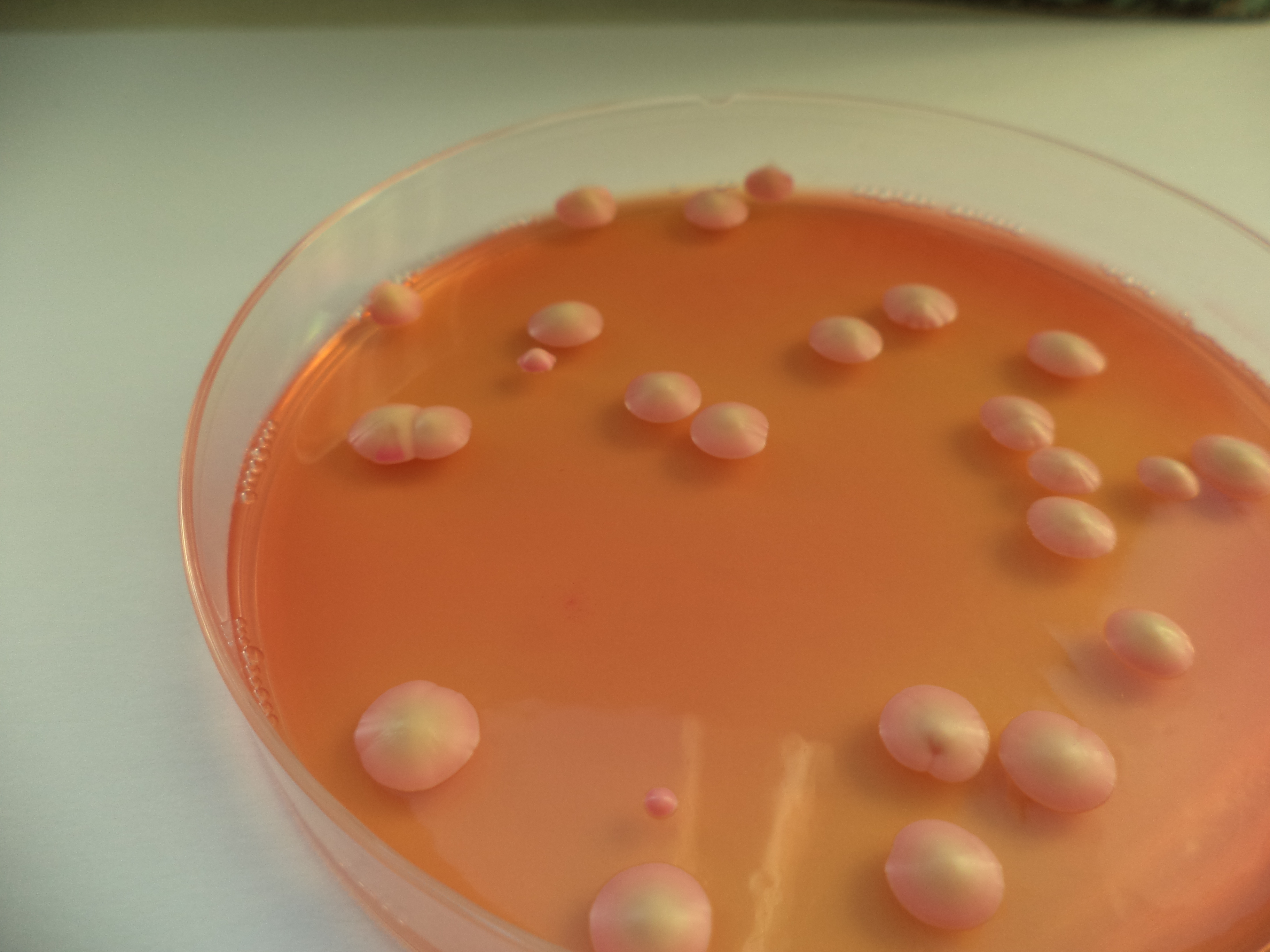 Brettanomyces plate 14